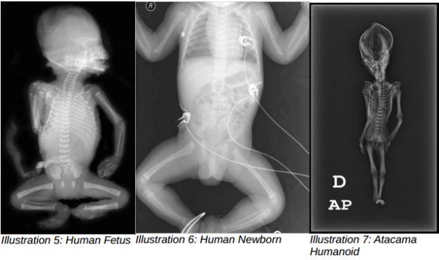 Um feto humano, à esquerda, comparado com o Ata.
