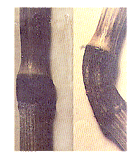 Nódulo normal comparado com um estendido, duma amostra extraída de um agroglifo.