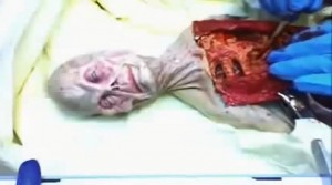 autopsia de ET