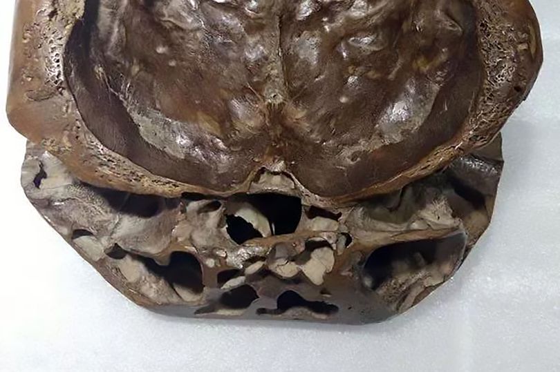 Escritor compartilha fotos de "crânio alienígena real"